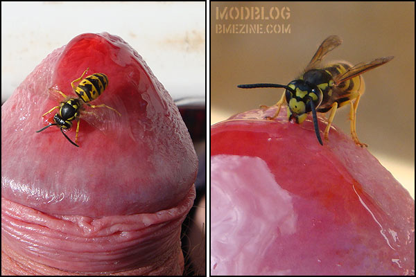 Bee Sting On Penis 43