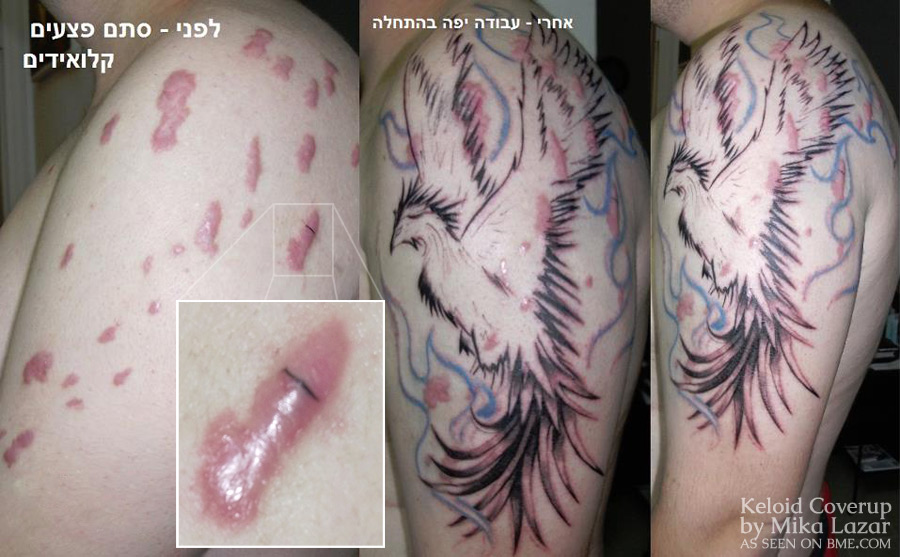 Keloid to Phoenix | BME: Tattoo, Piercing and Body ...