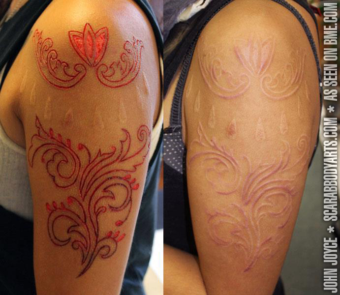 Flesh Removal Scarification | BME: Tattoo, Piercing and ...