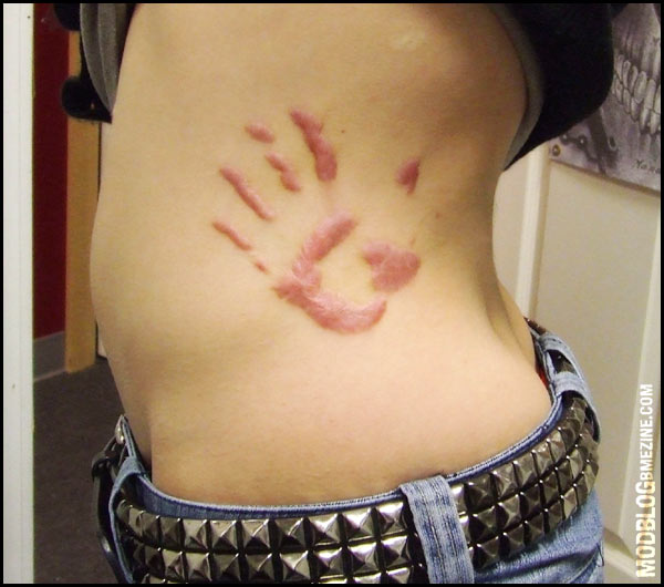 Healed scar handprint | BME: Tattoo, Piercing and Body Modification 