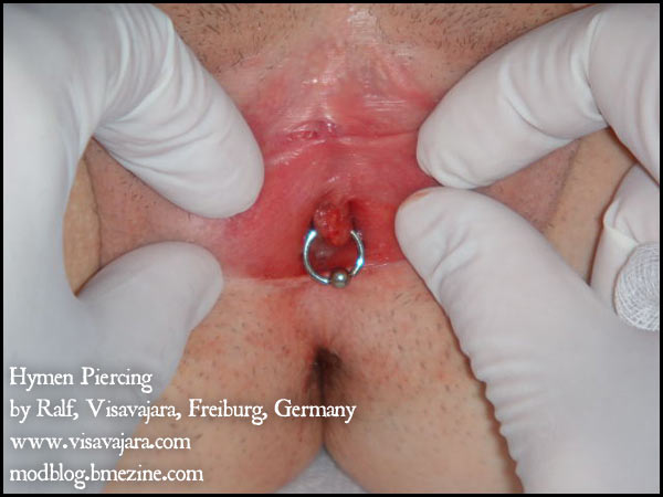The rarest piercing in the world? 