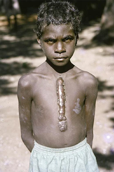 Traditional Body Modification Among Indigenous Australians