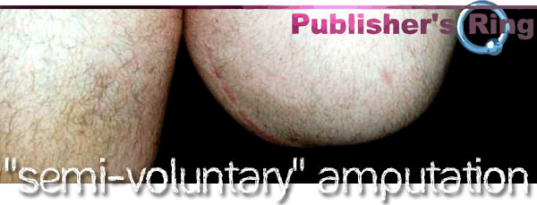 Semi-Voluntary Amputations