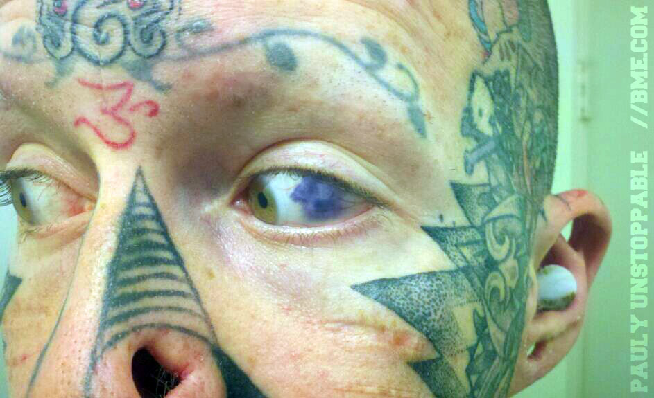 Model's Botched 'Eyeball Tattoo': The Dangers of Sclera Tattooing | Live  Science