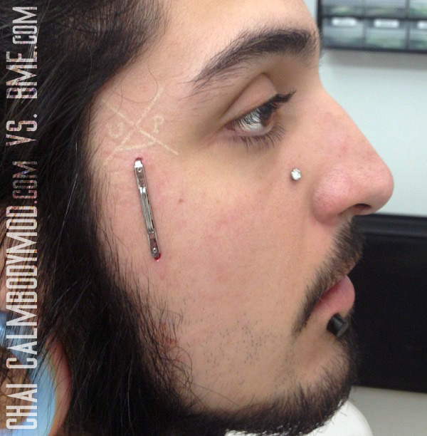 dermal piercing face scar