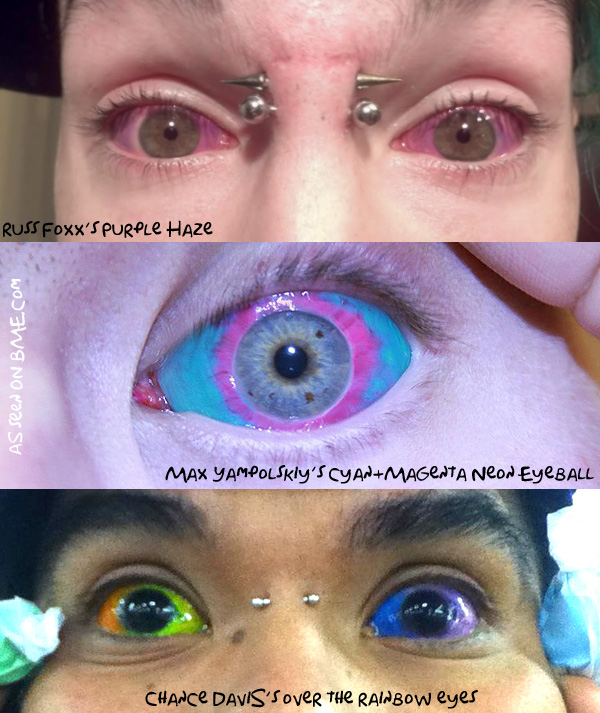 Selftattooing of eyeball with inadvertent corneoscleral perforation the  implication of social media  Eye