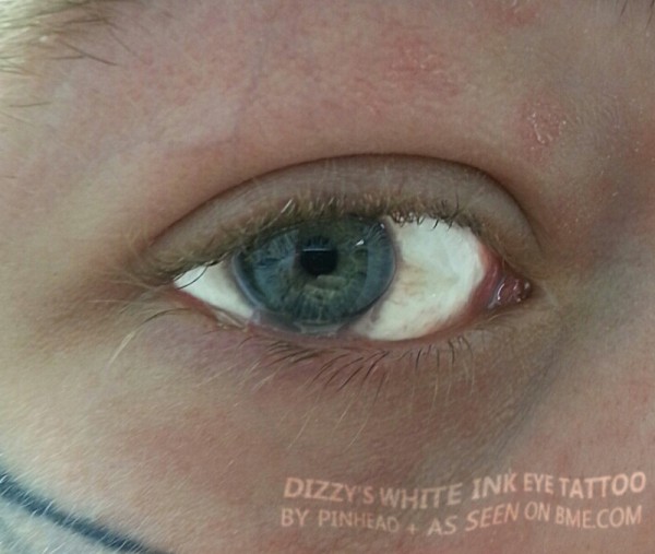 dizzy-white-eye-1