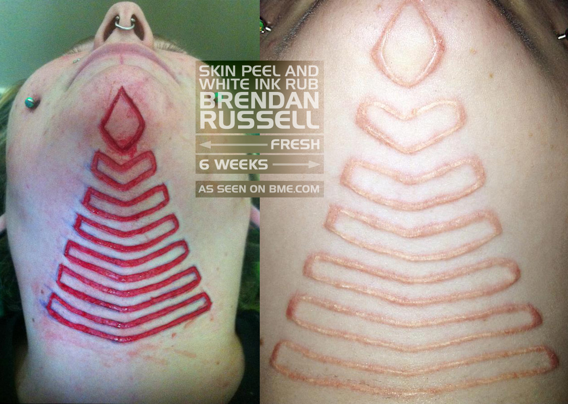 30 Times People Asked To Cover Up Their Scars, And This Tattoo Artist  Nailed It | Bored Panda