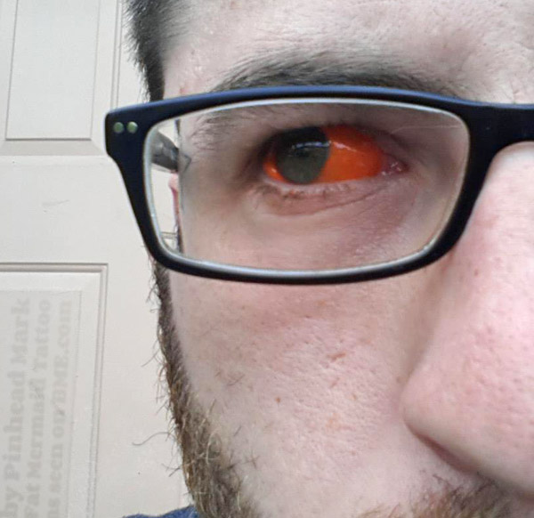 eyeballs-orange